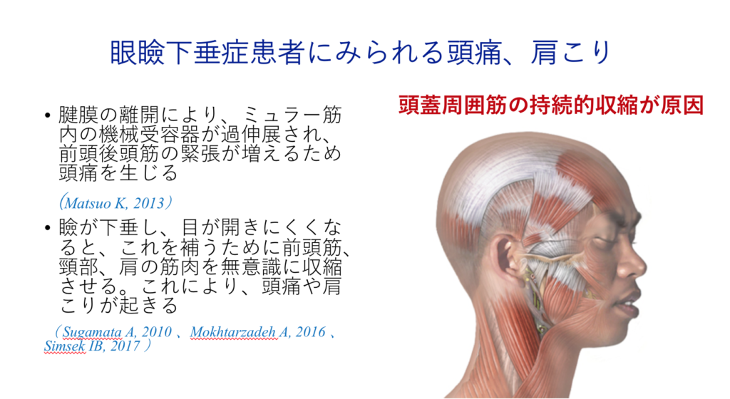 眼瞼下垂 パールスキンクリニック天神 院長ブログ